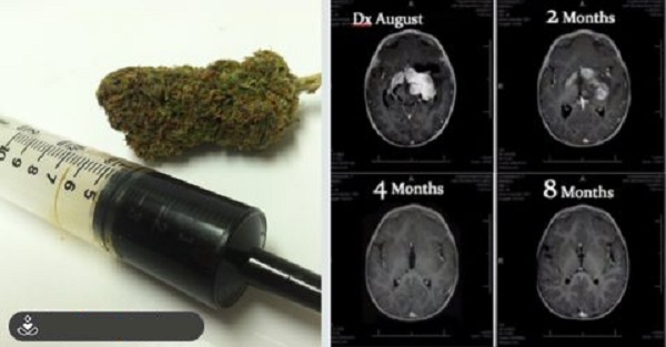 How-Marijuana-Destroys-Cancer-Cells.jpg